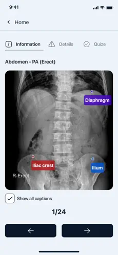 Xray Anatomy Study2